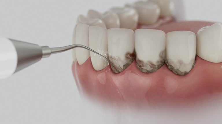 Trusted Teeth Cleaning And Checkup service in Charleroi, PA - Dentist Open Now